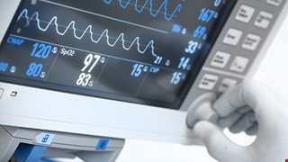 Transesophael echocardiography 經食道心臟超音波檢查