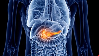 Acute Pancreatitis 急性胰臟炎