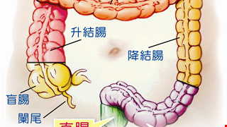 我要做大腸鏡，服用GI Klean腸見淨藥粉清腸，我要注意什麼？