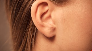 Preauricular fistula 耳前瘻管