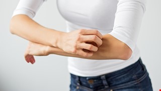 Atopic dermatitis 異位性皮膚炎預防與保健