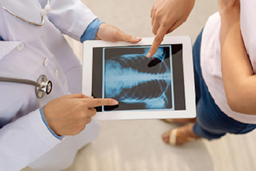 មហារីកសួត