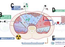 腹膜腫瘤溫熱治療中心-腹膜腫瘤整合性治療