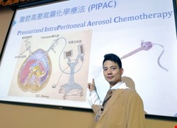 腹腔高壓氣霧化療對抗難處理的「腹膜惡性腫瘤」用噴的化療更精準！