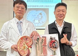 高血壓病17載 成功逆轉竟不藥而癒！ 醫精準揪出「原發性醛固酮過高症」 「續發性高血壓」全台估53萬人 找原因可斷病病灶