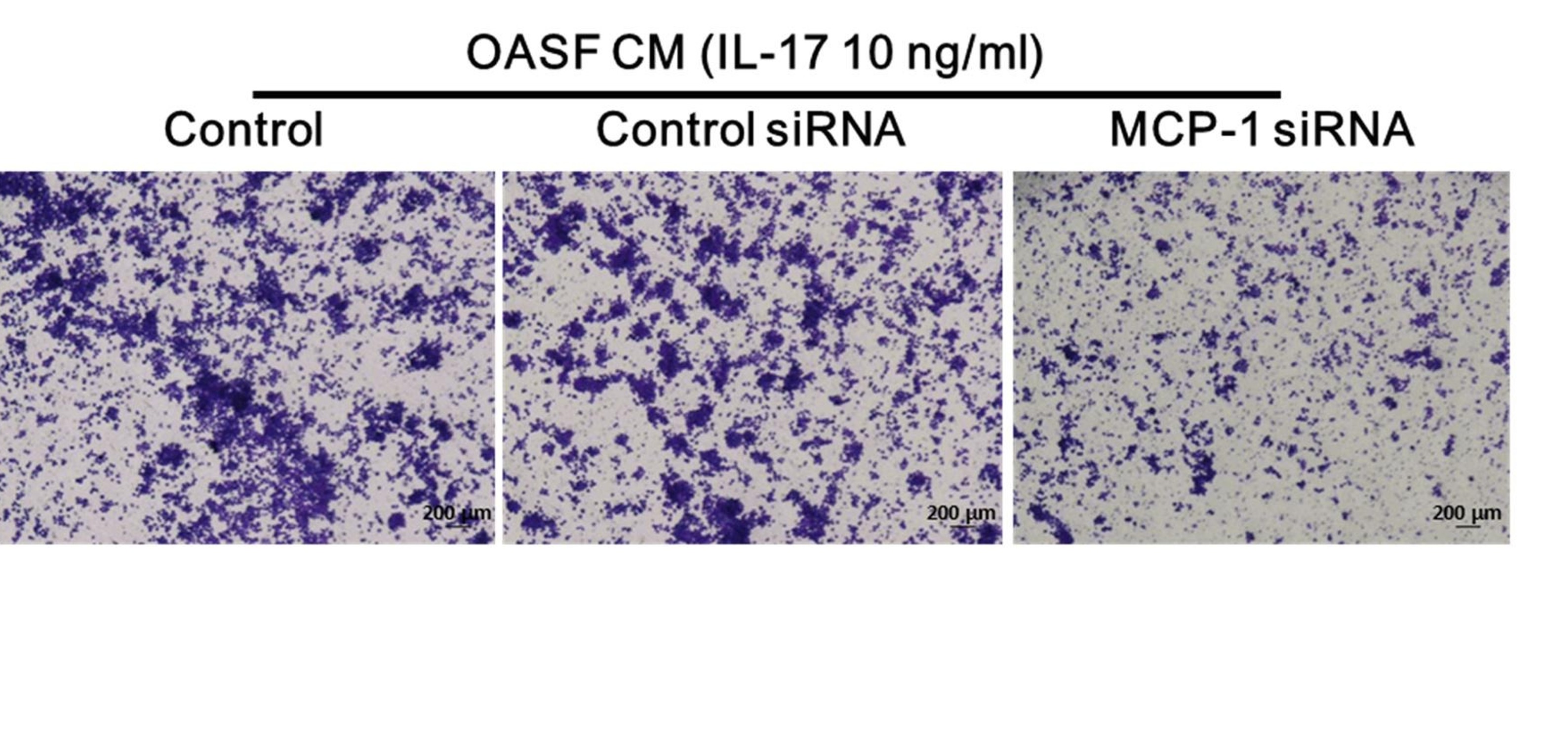 MCP-1 controls IL-17-promoted monocyte migration and M1 polarization in osteoarthritis