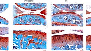 Cartilage-specific knockout of miRNA-128a expression normalizes the expression of circadian clock genes (CCGs) and mitigates the severity of osteoarthritis