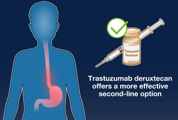 Trastuzumab Deruxtecan or Ramucirumab plus Paclitaxel in Gastric Cancer img
