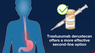 Trastuzumab Deruxtecan or Ramucirumab plus Paclitaxel in Gastric Cancer